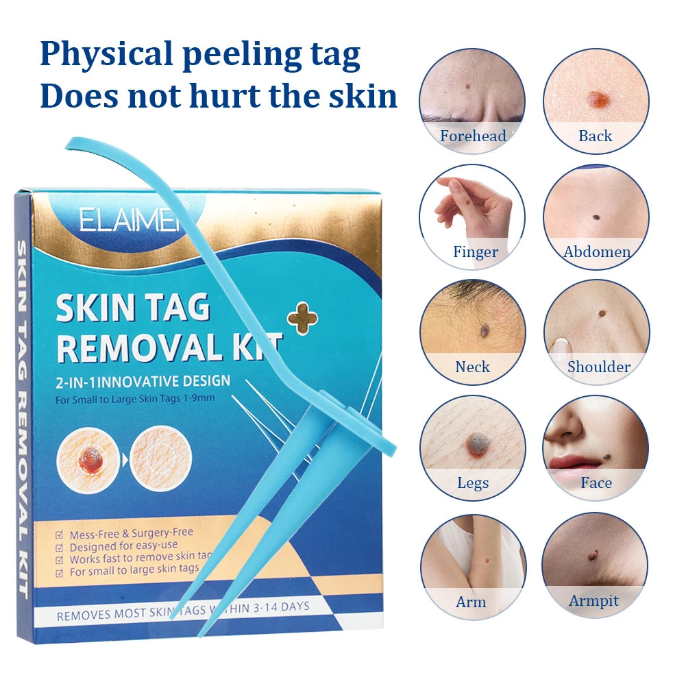 2 in 1 Auto Skin Tag Removal Kit Painless Mole Wart Remover Equipment Micro Skin Tag Treatment Tool Easy to Clean Skin Care Tool