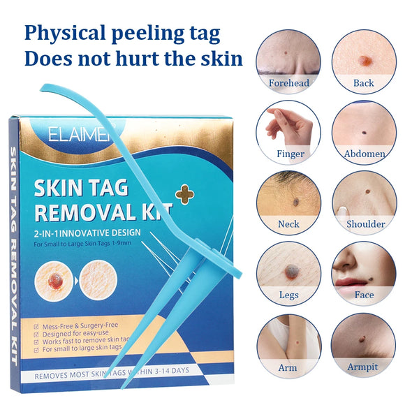 2 in 1 Auto Skin Tag Removal Kit Painless Mole Wart Remover Equipment Micro Skin Tag Treatment Tool Easy to Clean Skin Care Tool